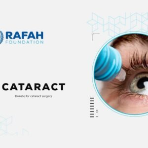 Cataract Operation